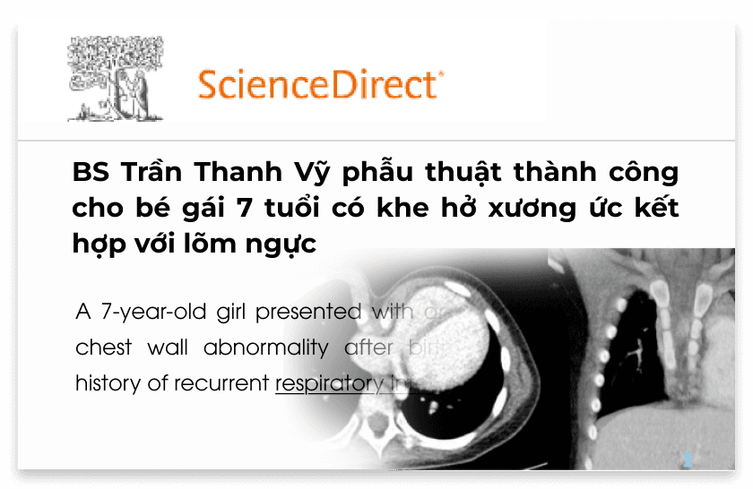 Bài báo và nghiên cứu khoa học số 4.