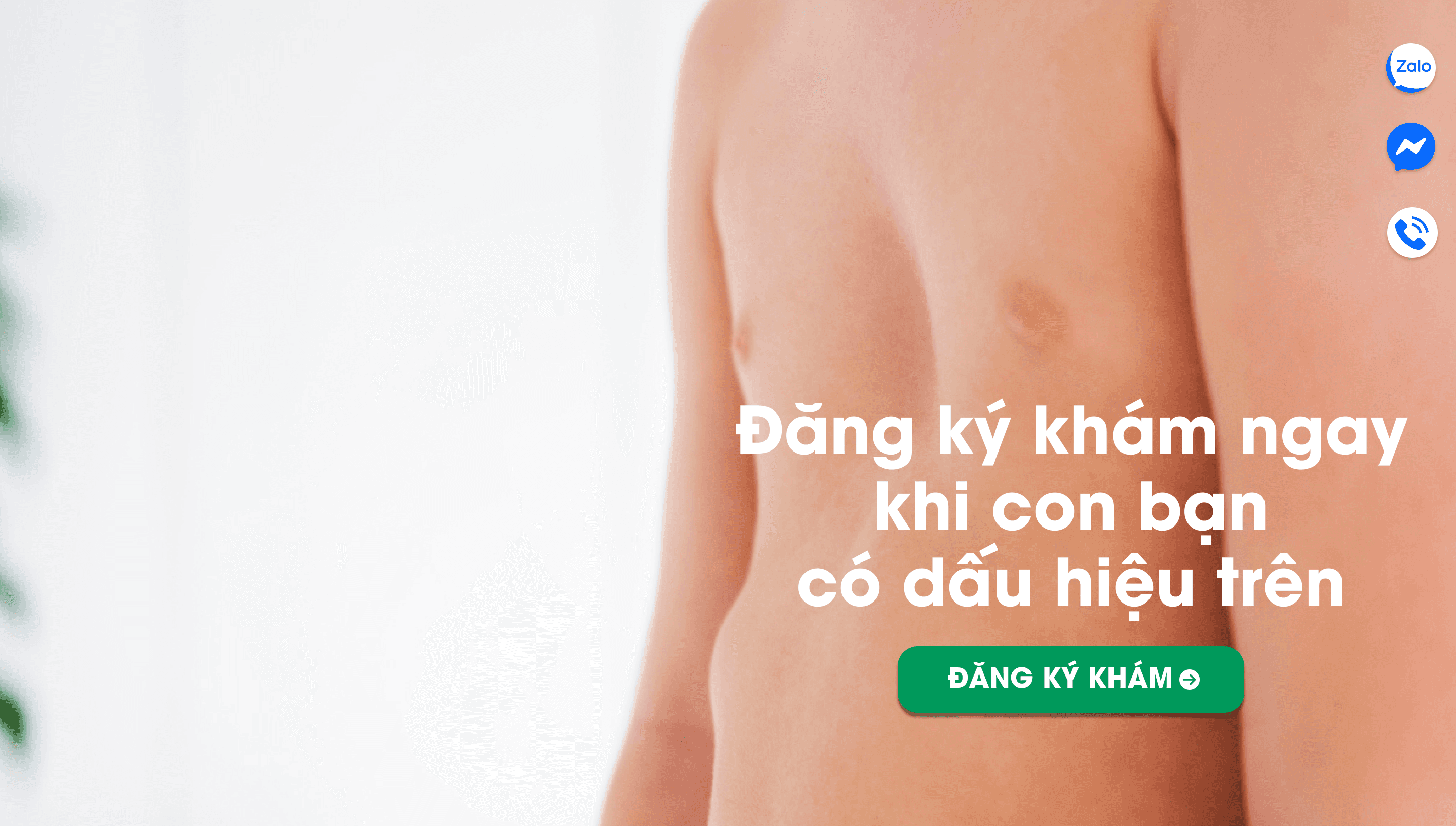 Bé có dấu hiệu lõm ngực trong phần lời kêu gọi đăng ký khám.